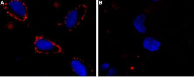 SCN3A (NaV1.3) (extracellular) Antibody in Immunocytochemistry (ICC/IF)