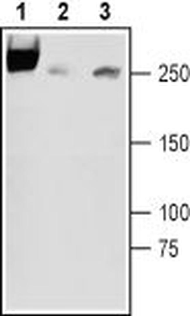 SCN3A (NaV1.3) (extracellular) Antibody in Western Blot (WB)