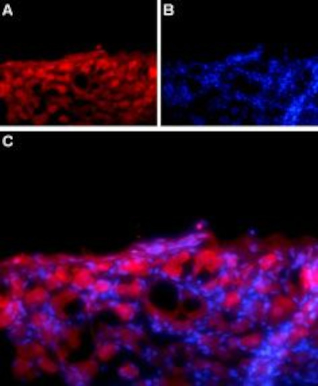 SCN1B (NaV beta 1) (extracellular) Antibody in Immunohistochemistry (IHC)