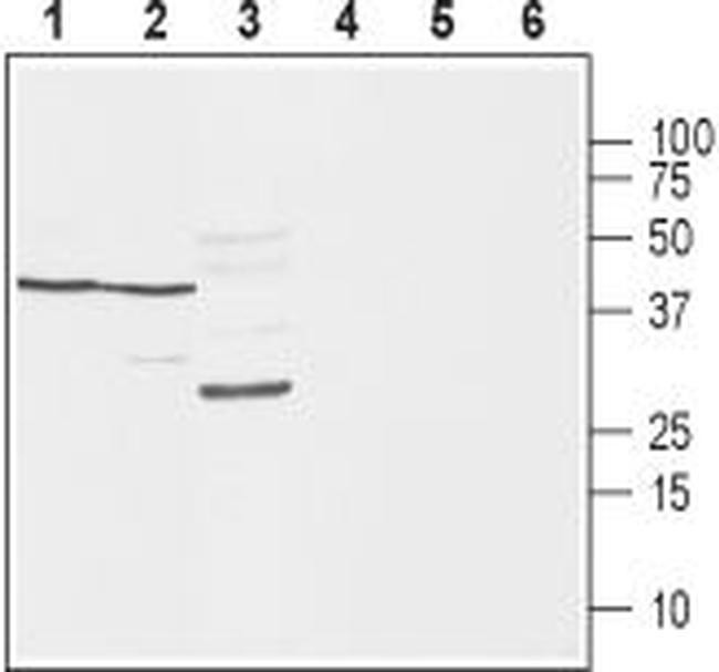 SCN1B (NaV beta 1) (extracellular) Antibody in Western Blot (WB)