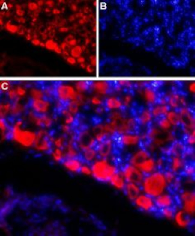 SCN4B (NaV beta 4) (extracellular) Antibody in Immunohistochemistry (IHC)