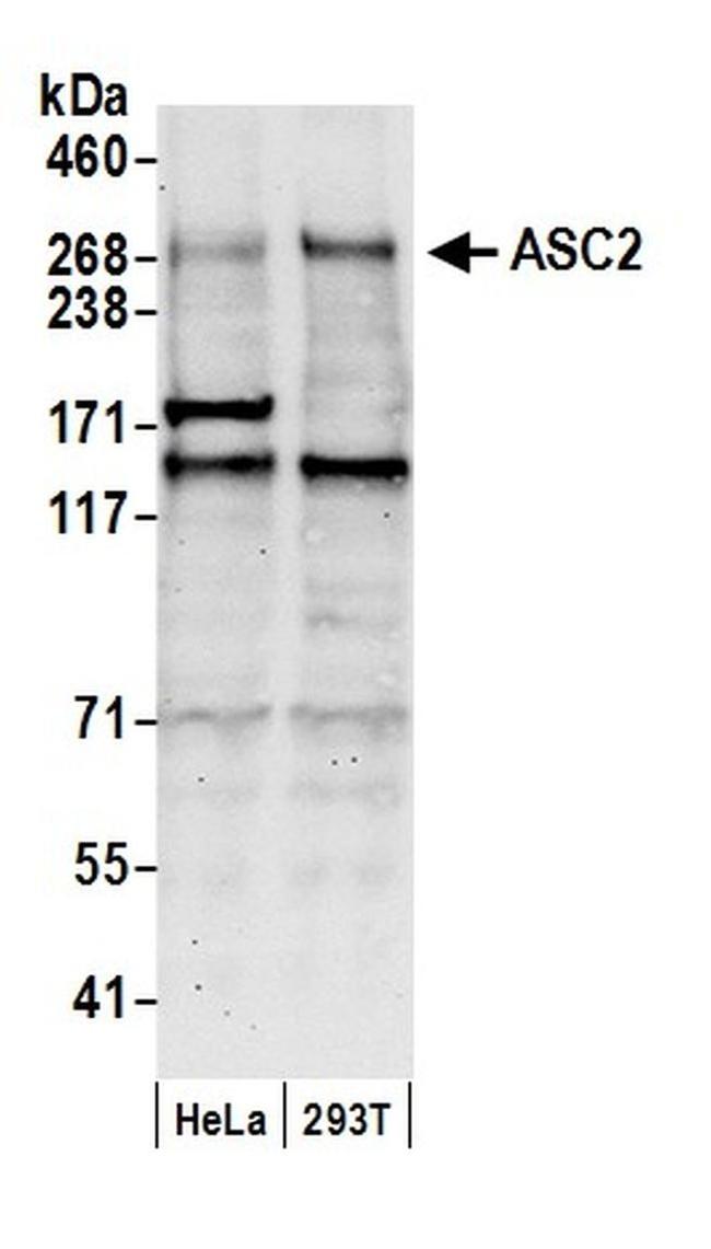 ASC2 Antibody in Western Blot (WB)