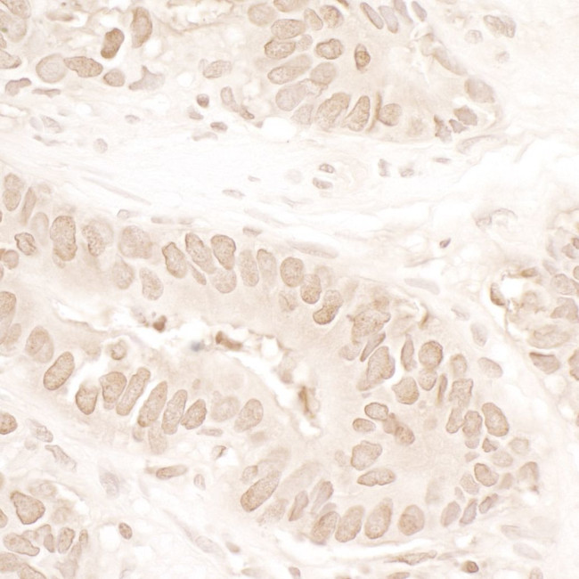 ASH1 Antibody in Immunohistochemistry (IHC)