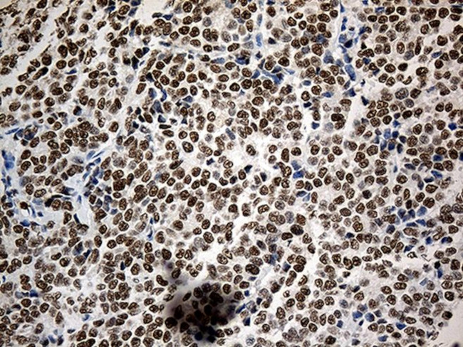 ASH2L Antibody in Immunohistochemistry (Paraffin) (IHC (P))