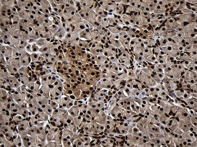 ASH2L Antibody in Immunohistochemistry (Paraffin) (IHC (P))