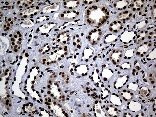 ASH2L Antibody in Immunohistochemistry (Paraffin) (IHC (P))