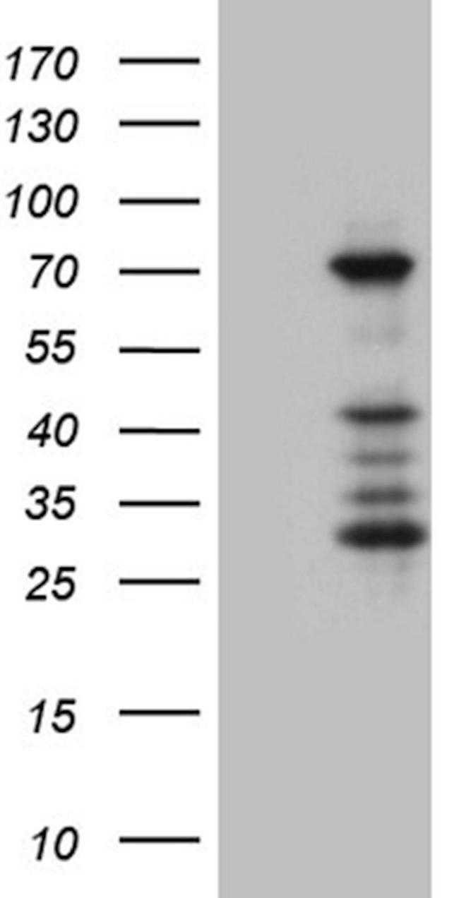 ASH2L Antibody in Western Blot (WB)