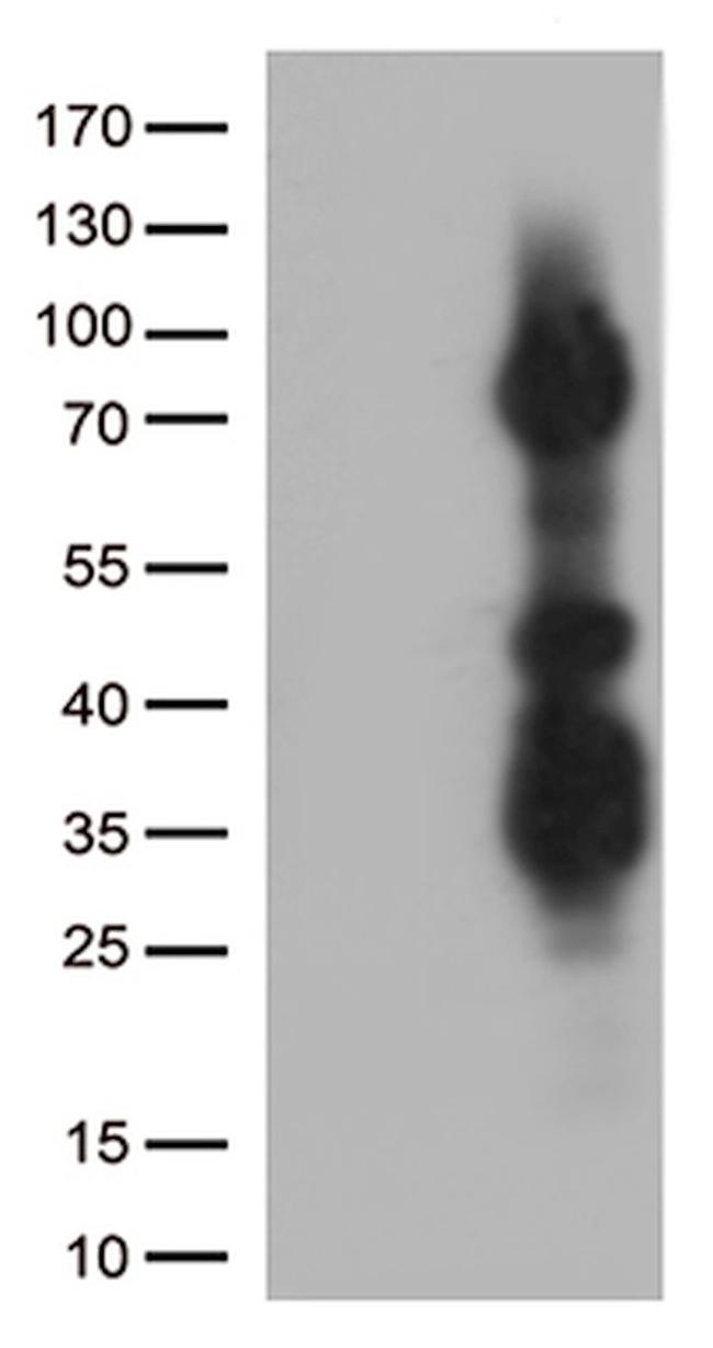 ASH2L Antibody in Western Blot (WB)