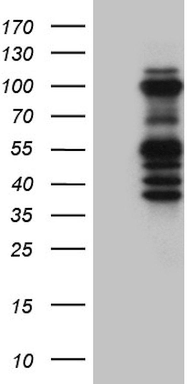 ASH2L Antibody in Western Blot (WB)