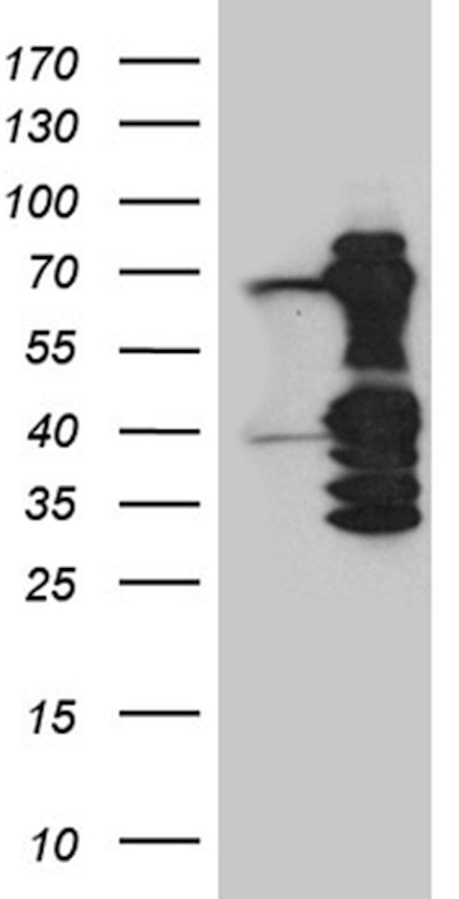 ASH2L Antibody in Western Blot (WB)