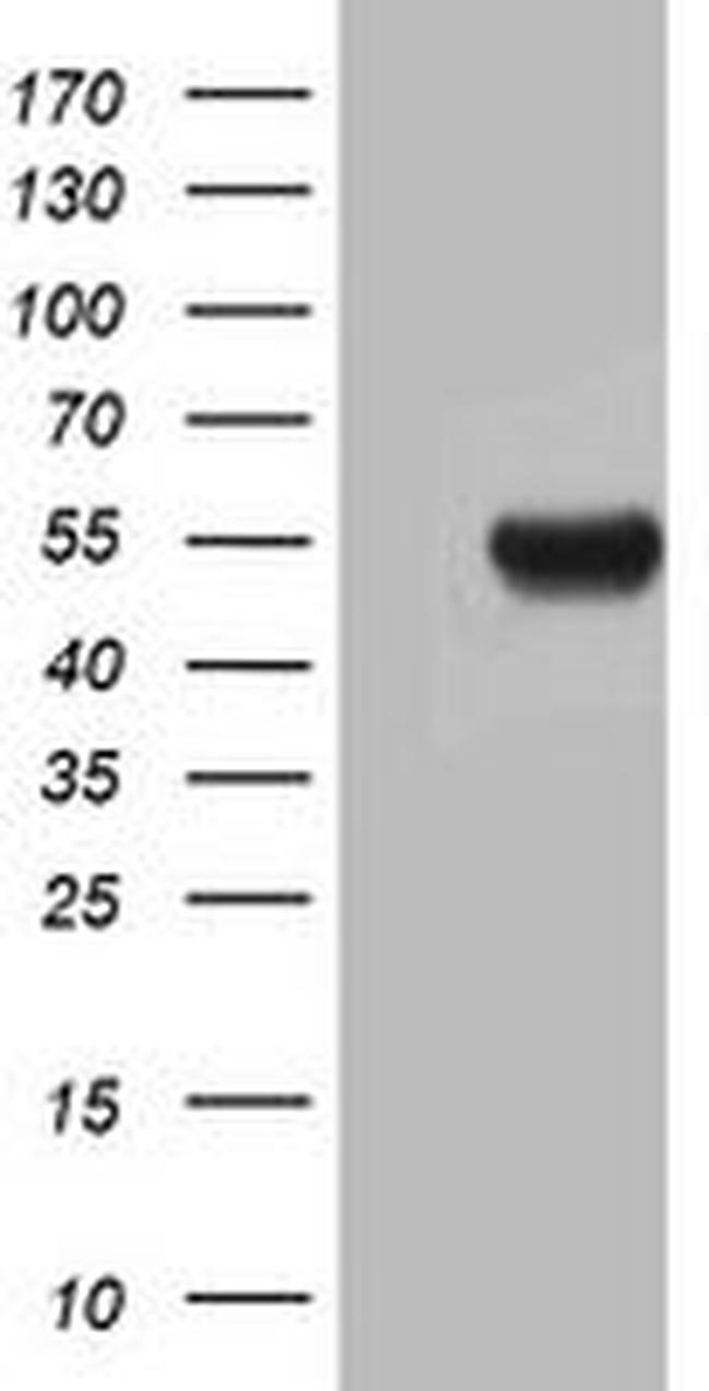 ASL Antibody in Western Blot (WB)