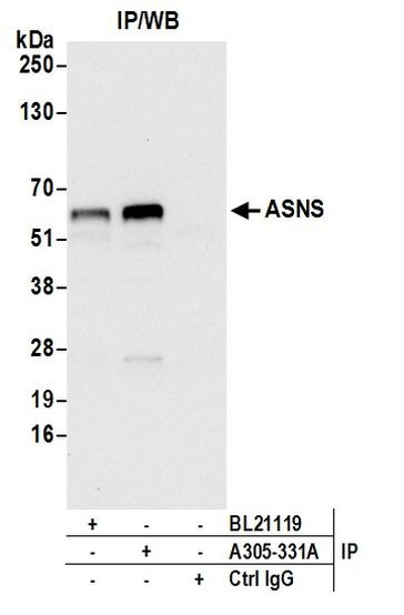 ASNS/Asparagine Synthetase Antibody in Immunoprecipitation (IP)