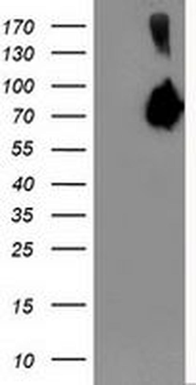 ASNS Antibody in Western Blot (WB)