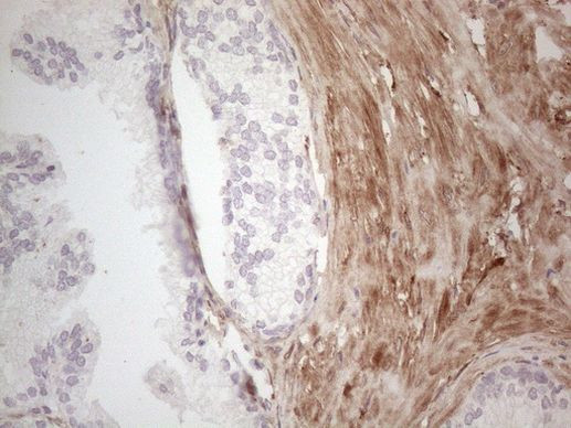 ASPA Antibody in Immunohistochemistry (Paraffin) (IHC (P))