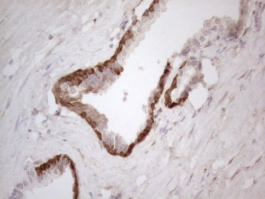 ASPA Antibody in Immunohistochemistry (Paraffin) (IHC (P))