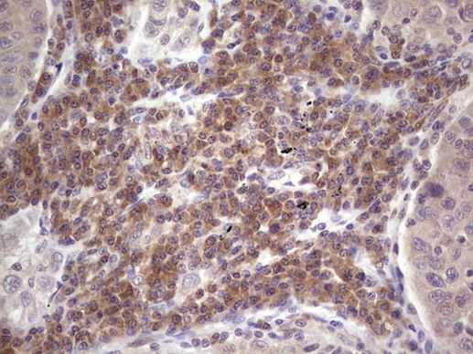 ASPA Antibody in Immunohistochemistry (Paraffin) (IHC (P))