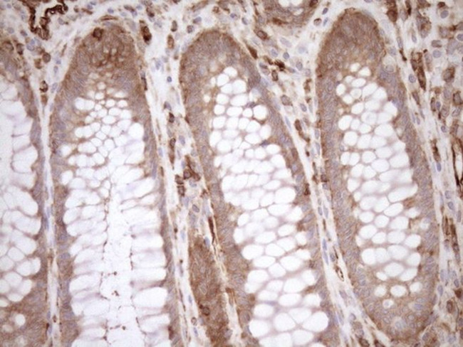 ASPDH Antibody in Immunohistochemistry (Paraffin) (IHC (P))