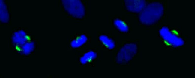 ASPM Antibody in Immunocytochemistry (ICC/IF)