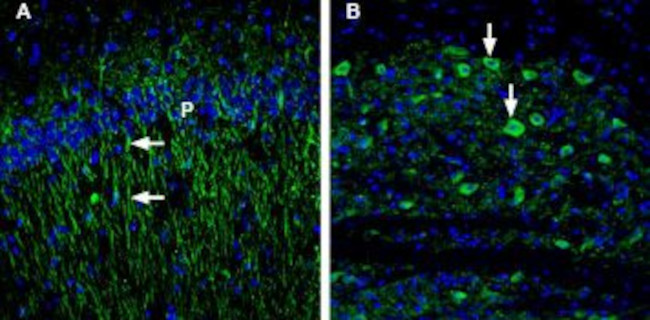 5HT1B Receptor (HTR1B) (extracellular) Antibody in Immunohistochemistry (IHC)