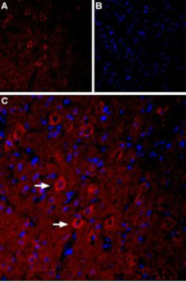 5HT3A Receptor (HTR3A) Antibody in Immunohistochemistry (IHC)