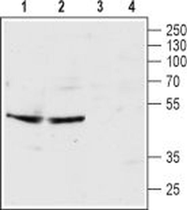 5HT3B Receptor (HTR3B) (extracellular) Antibody in Western Blot (WB)