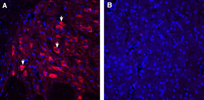 5HT2A Receptor (HTR2A) (extracellular) Antibody in Immunohistochemistry (Frozen) (IHC (F))