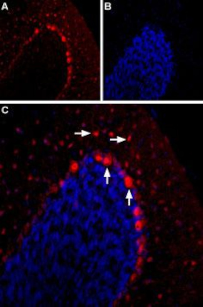 5HT2B Receptor (HTR2B) (extracellular) Antibody in Immunohistochemistry (IHC)