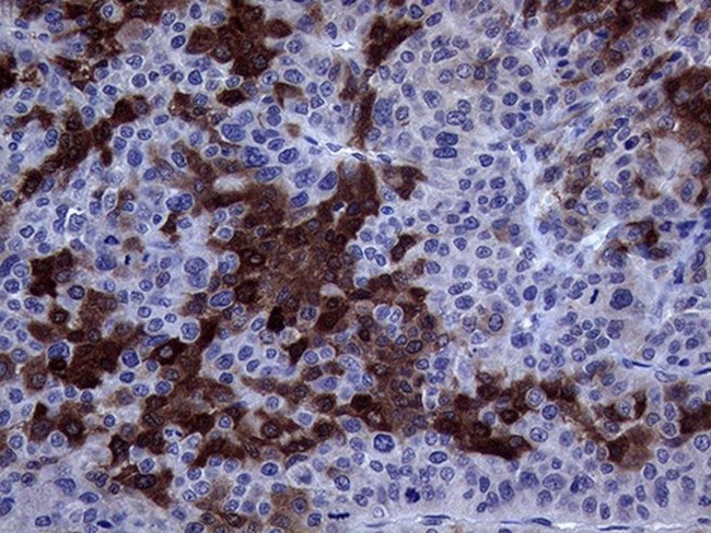 ASS1 Antibody in Immunohistochemistry (Paraffin) (IHC (P))