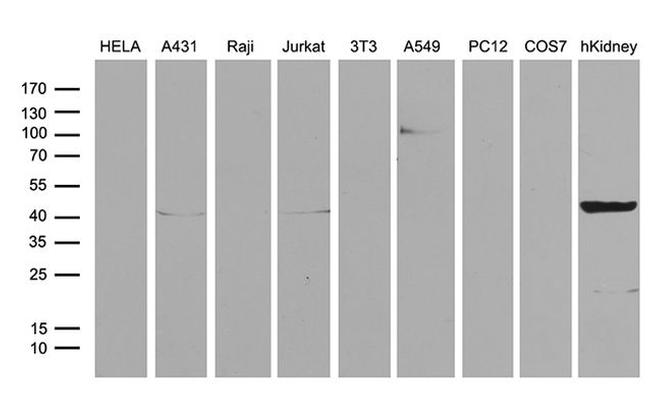 ASS1 Antibody in Western Blot (WB)