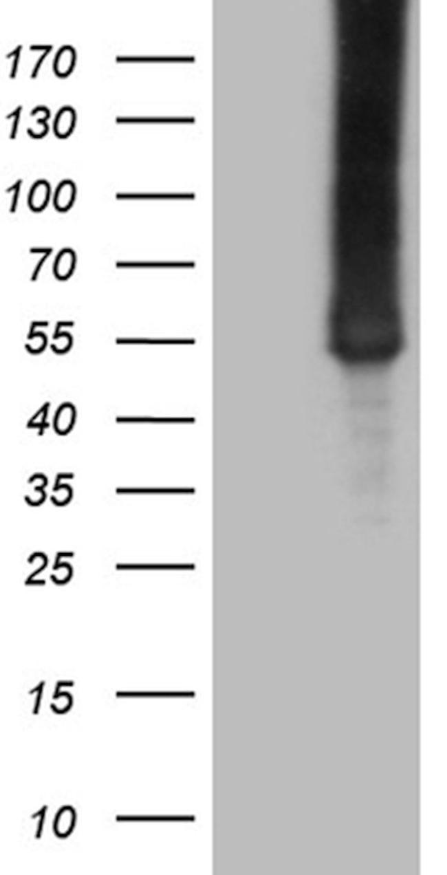 ASS1 Antibody in Western Blot (WB)