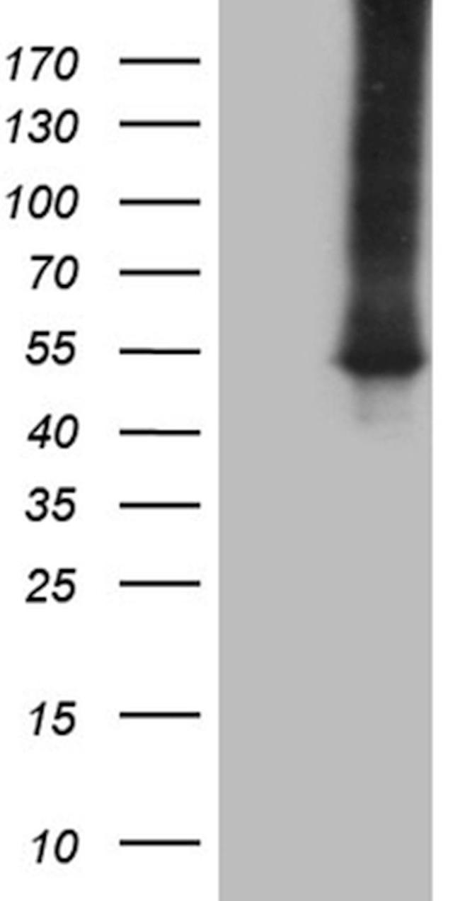 ASS1 Antibody in Western Blot (WB)