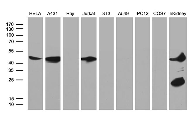 ASS1 Antibody in Western Blot (WB)