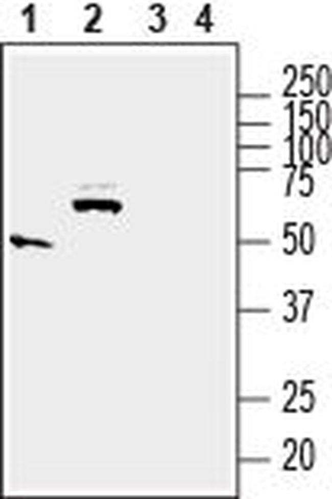 SLC17A5 (Sialin) Antibody in Western Blot (WB)