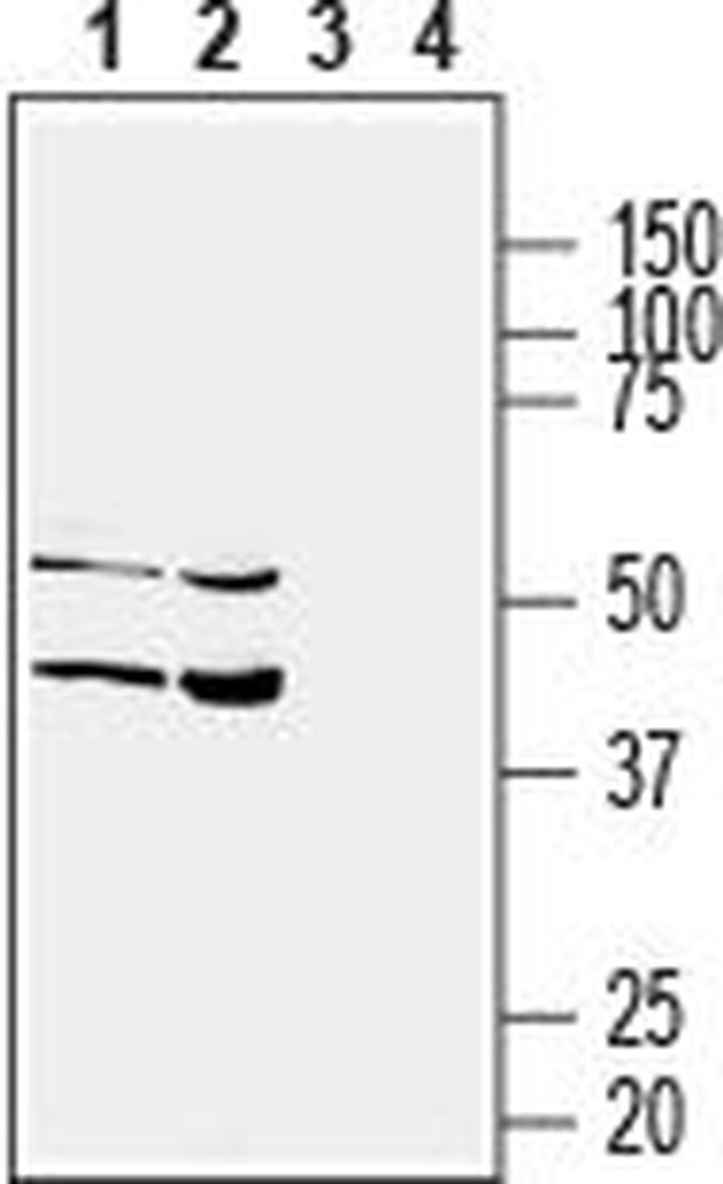 SLC17A5 (Sialin) Antibody in Western Blot (WB)