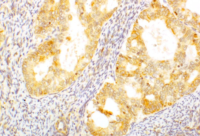 AGTR2 Antibody in Immunohistochemistry (IHC)