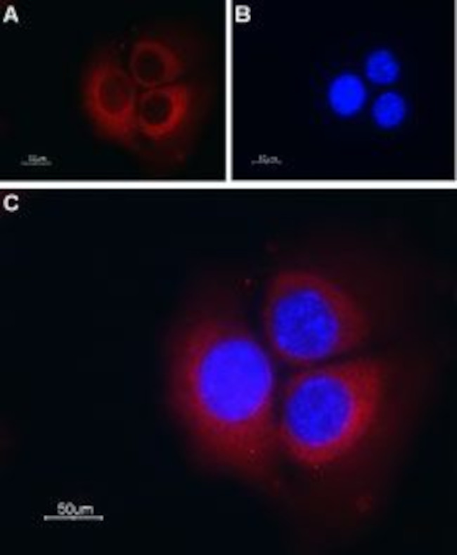 TRIC-B (TMEM38B) Antibody in Immunocytochemistry (ICC/IF)