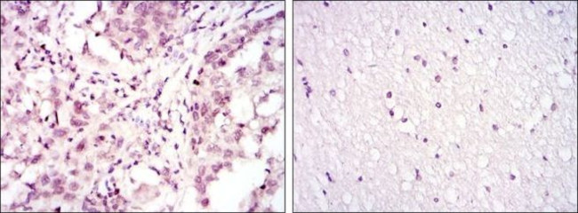 ATF2 Antibody in Immunohistochemistry (Paraffin) (IHC (P))