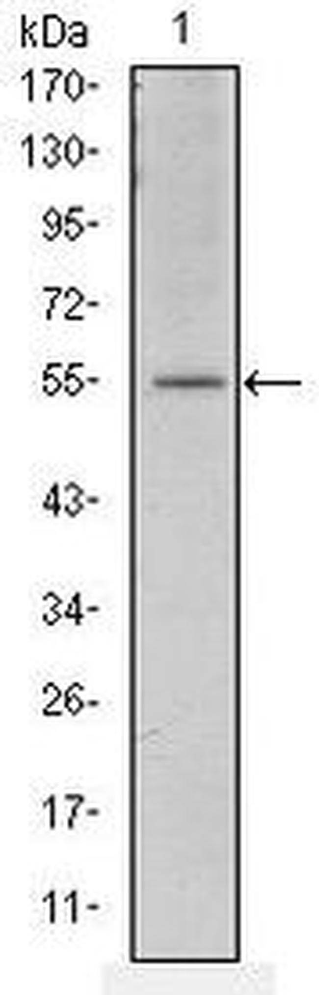 ATF2 Antibody in Western Blot (WB)