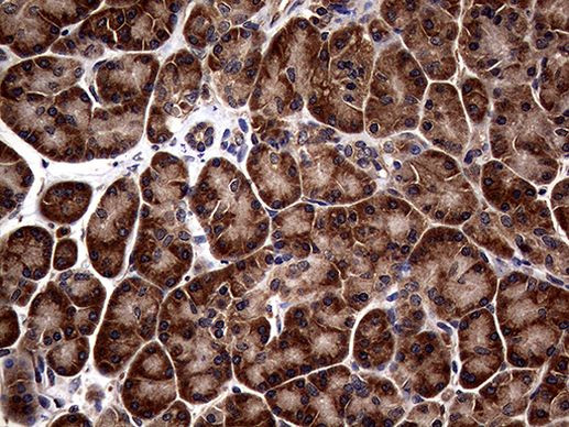 ATG16L1 Antibody in Immunohistochemistry (Paraffin) (IHC (P))