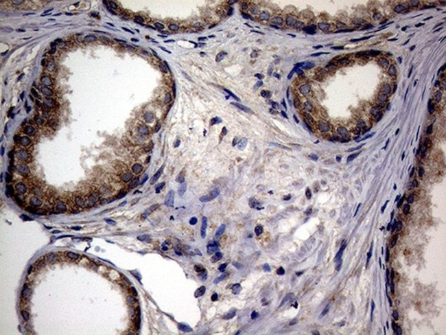 ATG16L1 Antibody in Immunohistochemistry (Paraffin) (IHC (P))