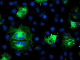 ATG3 Antibody in Immunocytochemistry (ICC/IF)