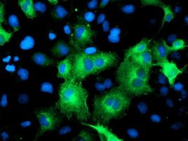 ATG3 Antibody in Immunocytochemistry (ICC/IF)