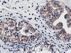 ATG3 Antibody in Immunohistochemistry (Paraffin) (IHC (P))