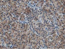 ATG3 Antibody in Immunohistochemistry (Paraffin) (IHC (P))