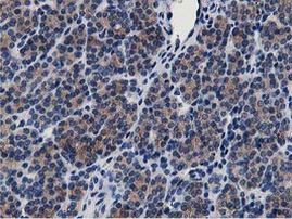 ATG3 Antibody in Immunohistochemistry (Paraffin) (IHC (P))