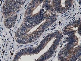 ATG3 Antibody in Immunohistochemistry (Paraffin) (IHC (P))