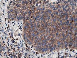 ATG3 Antibody in Immunohistochemistry (Paraffin) (IHC (P))