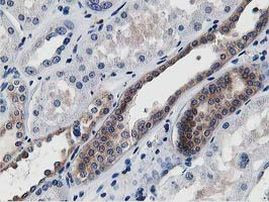 ATG3 Antibody in Immunohistochemistry (Paraffin) (IHC (P))