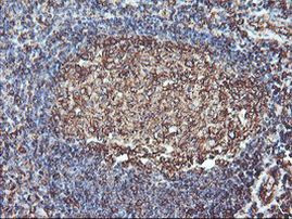 ATG3 Antibody in Immunohistochemistry (Paraffin) (IHC (P))