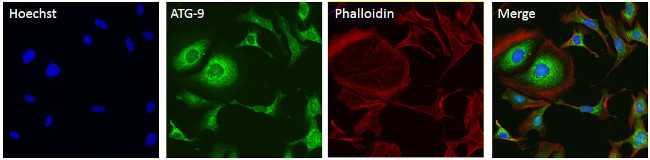 ATG9A Antibody in Immunocytochemistry (ICC/IF)